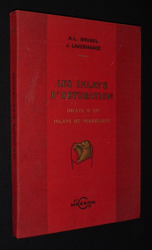 Les Inlays d'obturation : Inlays d'or, inlays de porcelaine